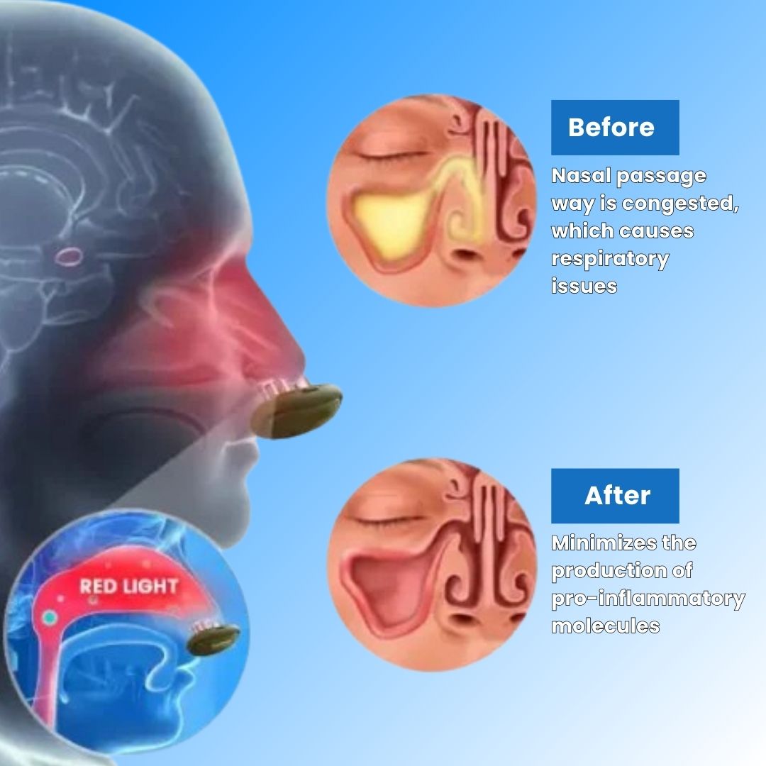 ComfyNas™ - Comfortable Nasal Solution