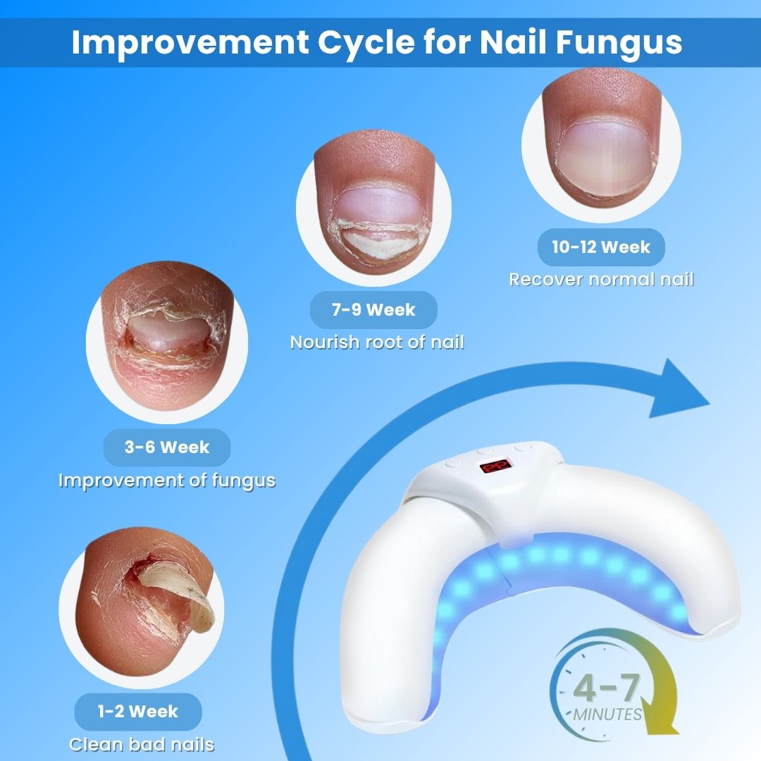 NailCure Pro™ - Laser Nail Treatment Device