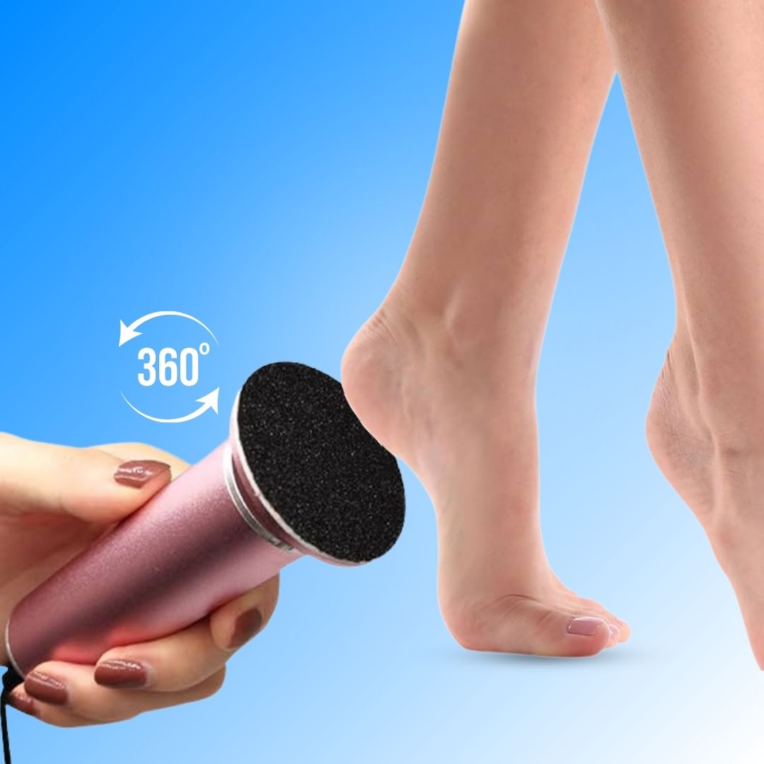 CallusCut™ - Electric Foot Callus Remover