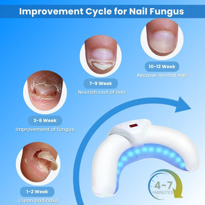 NailCure Pro™ - Laser Nail Treatment Device