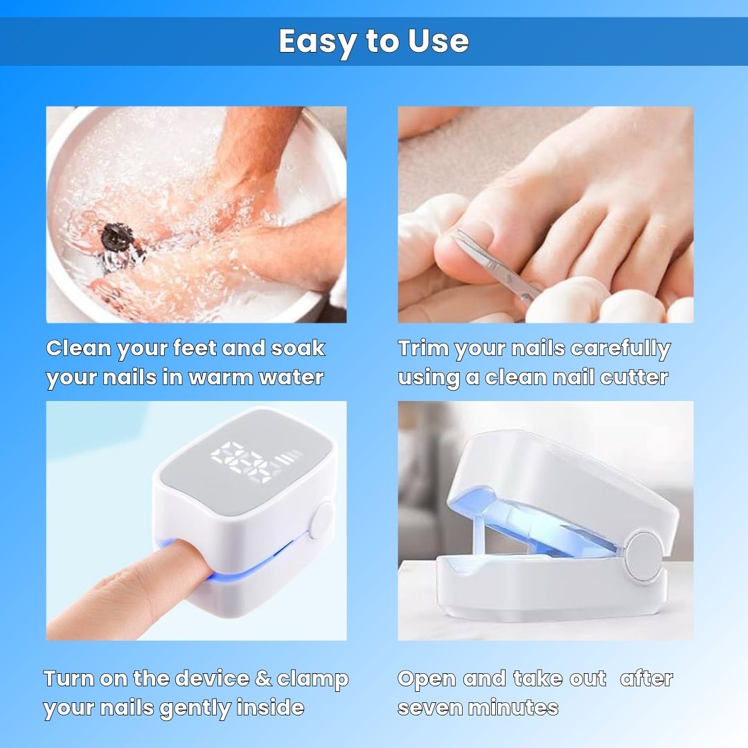 Nail Fungus Treatment Tools Fungal Nail Treatment Device Anti-Equipment Effectively Remove Fungal Toenail Nail Fungal Infection
