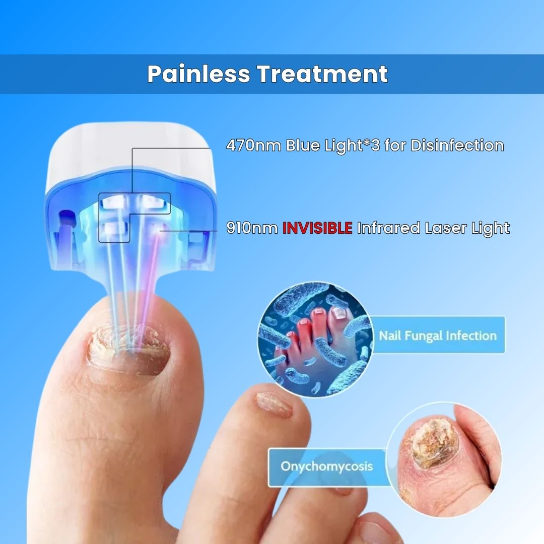 Nail Fungus Treatment Tools Fungal Nail Treatment Device Anti-Equipment Effectively Remove Fungal Toenail Nail Fungal Infection
