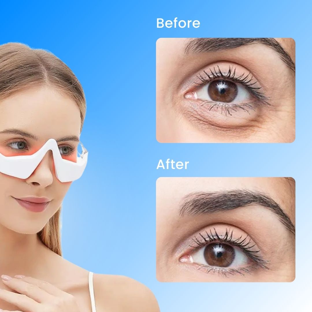LumeEye™ - Dark Circle Eliminator Pro